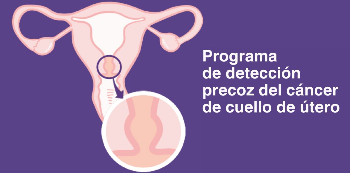 Salut y el Consell de Col·legis Farmacèutics de Catalunya desarrollan un programa piloto de detección precoz de cáncer de cuello de útero con automuestra en las farmacias