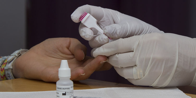 Programa de detección precoz del VIH con test rápido